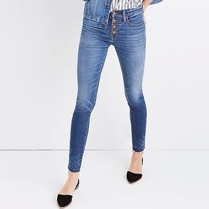 Button Fly Skinny Jeans